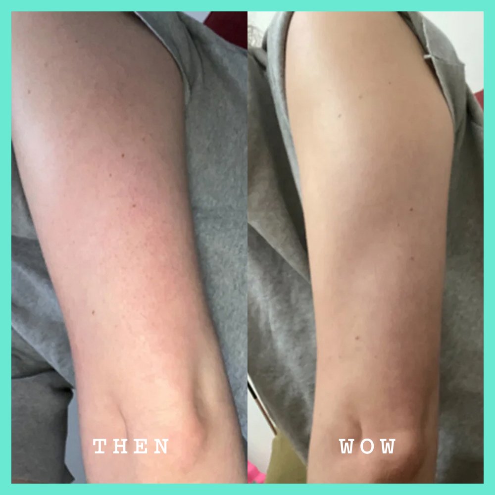 Before and After Smoothing AHA Body Lotion