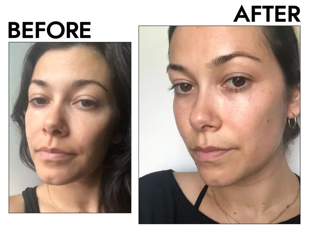 Best Antioxidant Serums for Pollution-Exposed Skin 2025