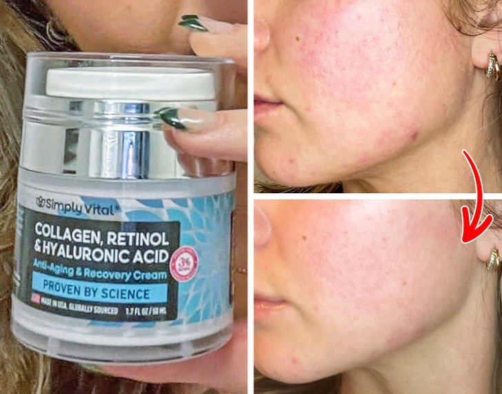 Best Collagen-Boosting Creams for Décolletage and Chest 2025