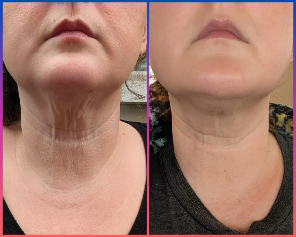 Best Collagen-Boosting Creams for Décolletage and Chest 2025