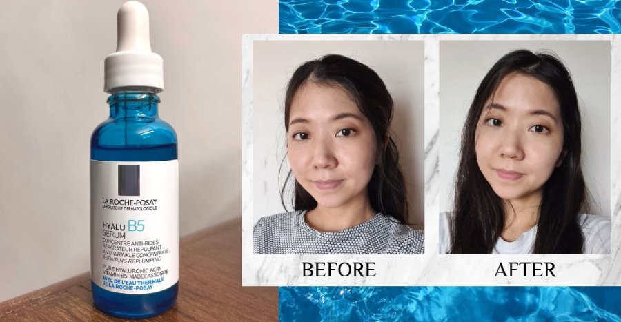 Best Eye Serums for Tired Eyes 2025