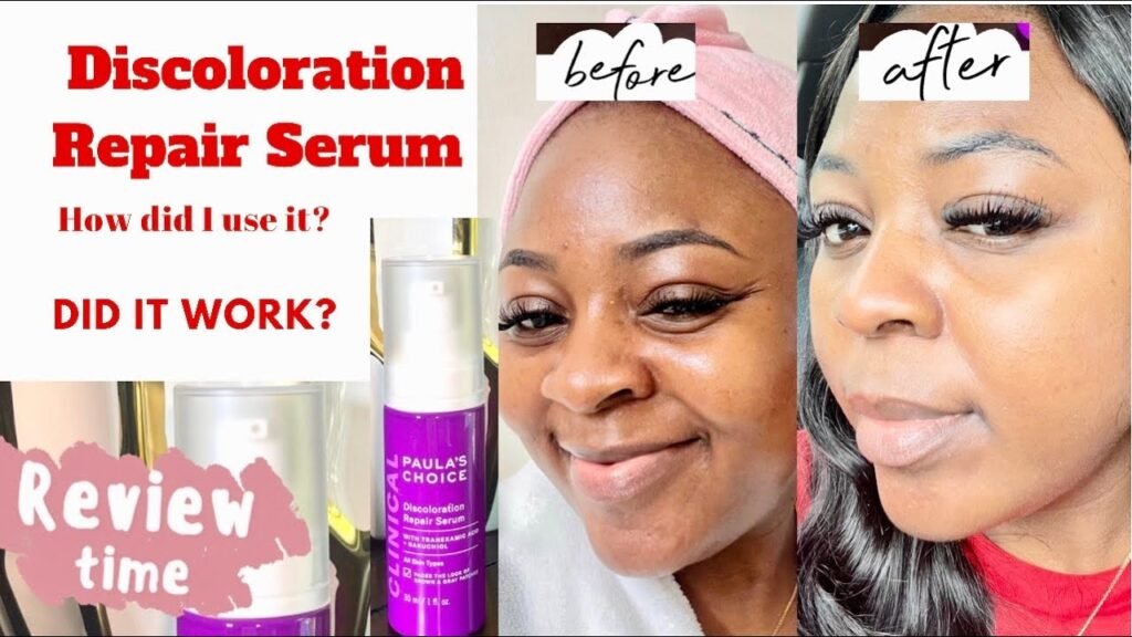 Best Products for Melasma 2025