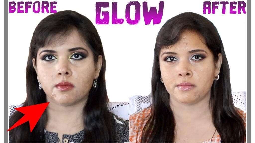 Best Glycolic Acid Toners 2025