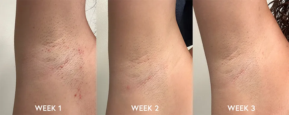 post-wax repair balm for sensitive skin 2025