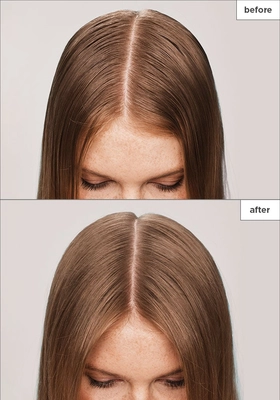 best scalp serums thinning hair and irritated scalp 2025