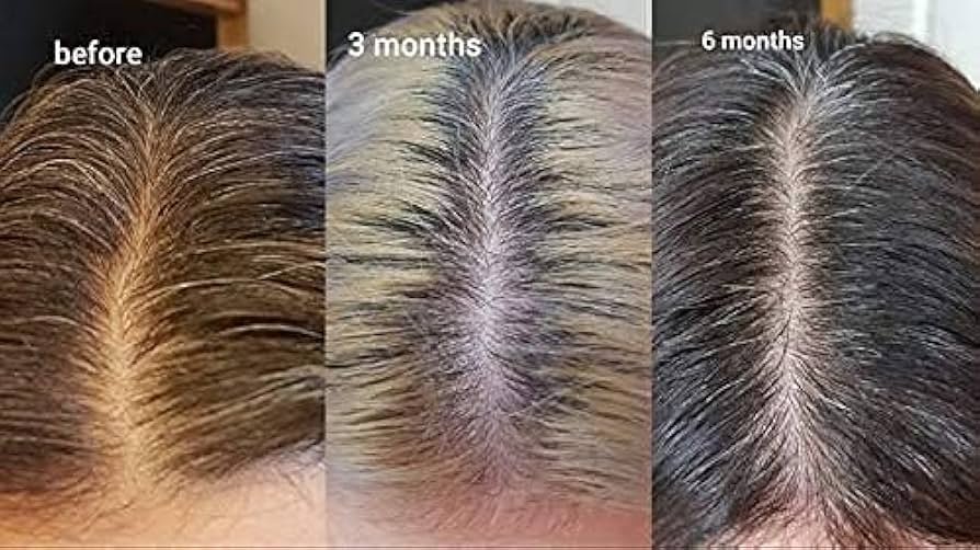 best scalp serums thinning hair and irritated scalp 2025