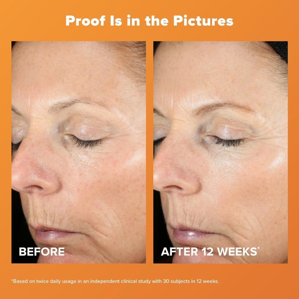 Best Anti-Yellowing Skincare for Smokers 2025