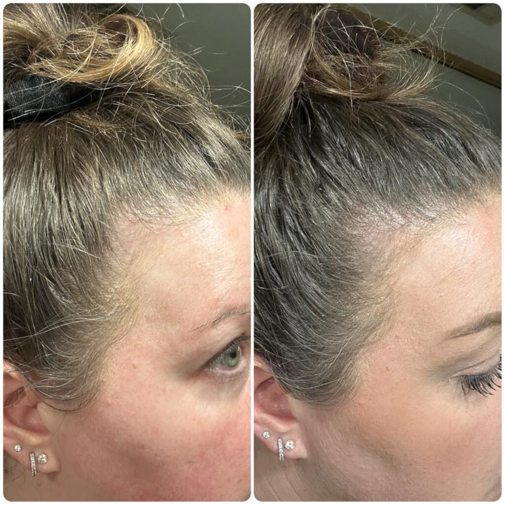 best scalp serums thinning hair and irritated scalp 2025