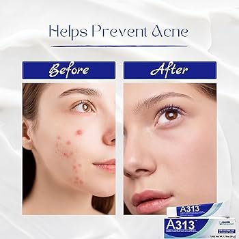 Best Boutique French Creams 2025