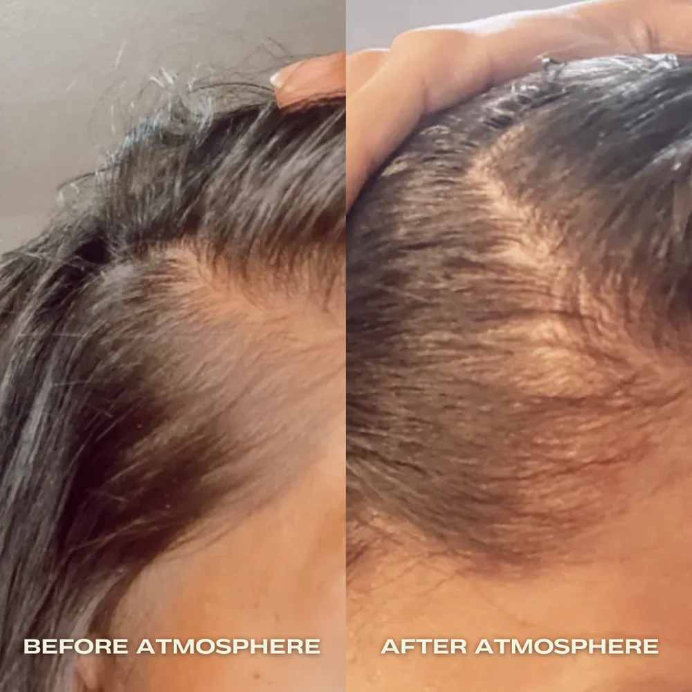best scalp serums thinning hair and irritated scalp 2025
