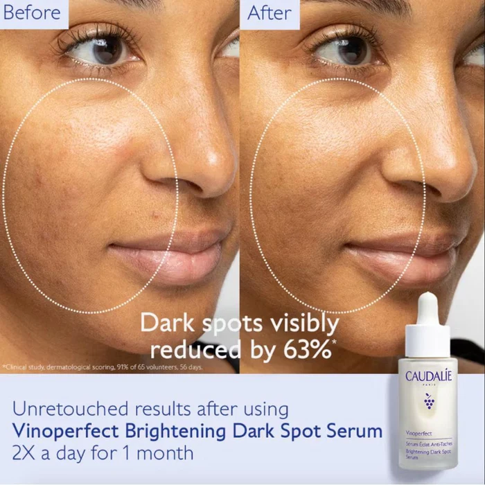 Best Antioxidant-Rich Facial Mists 2025