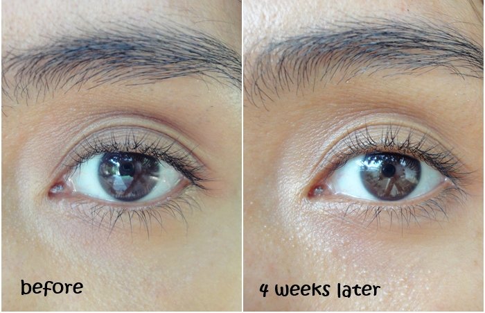 Best Luxury Eye Treatments 2025