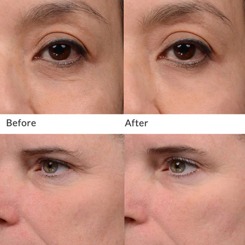 Best PHA Exfoliants for Very Sensitive and Mature Skin 2025