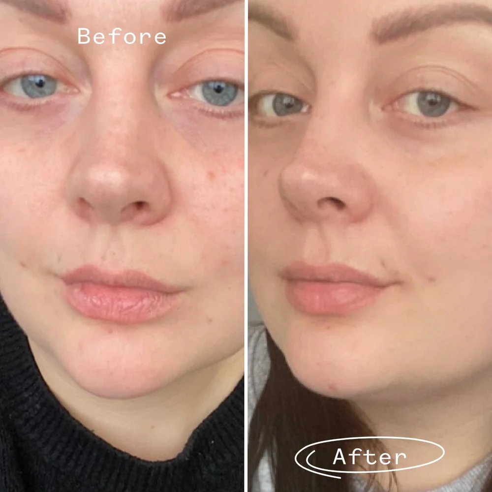 Cold-Pressed Facial Oils 2025