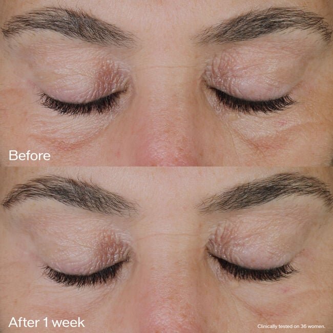 Best Luxury Eye Treatments 2025