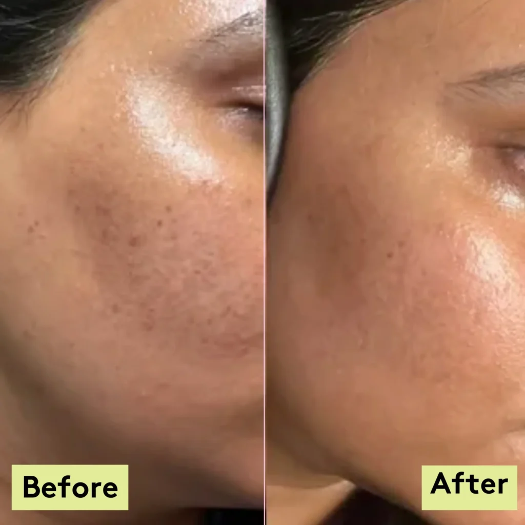 Cold-Pressed Facial Oils 2025