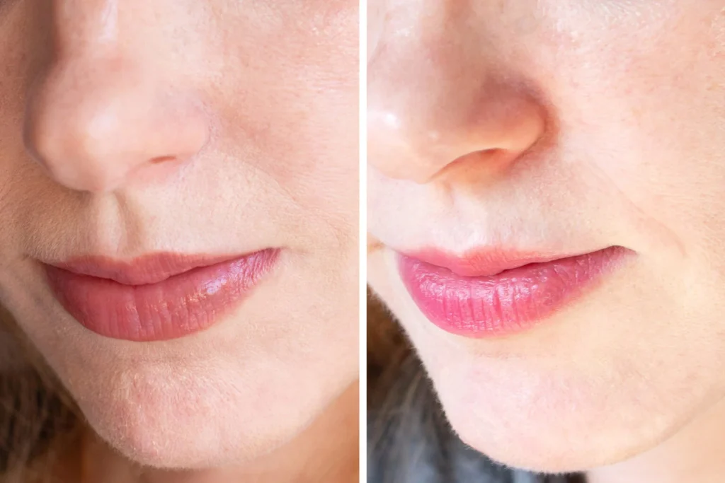 Best Boutique French Creams 2025