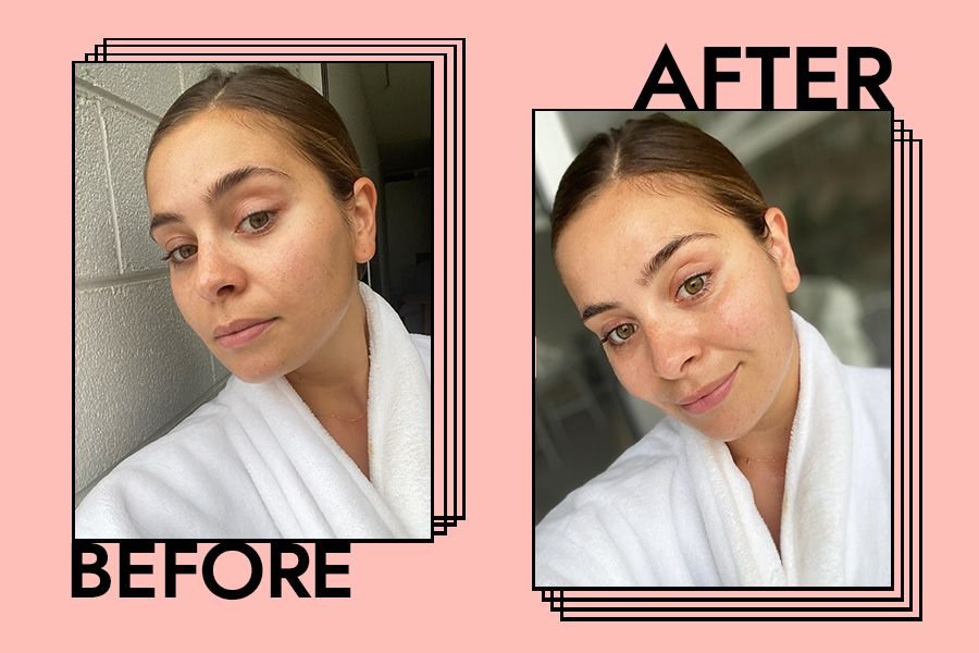 Best Soothing Sprays for Sensitive Skin 2025