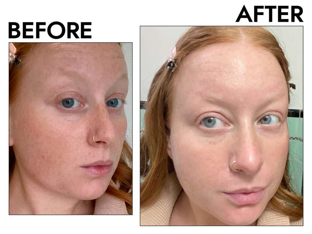 Best Nighttime Oil-Control Products 2025