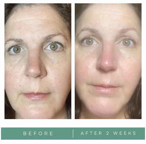 Best Antioxidant-Rich Facial Mists 2025