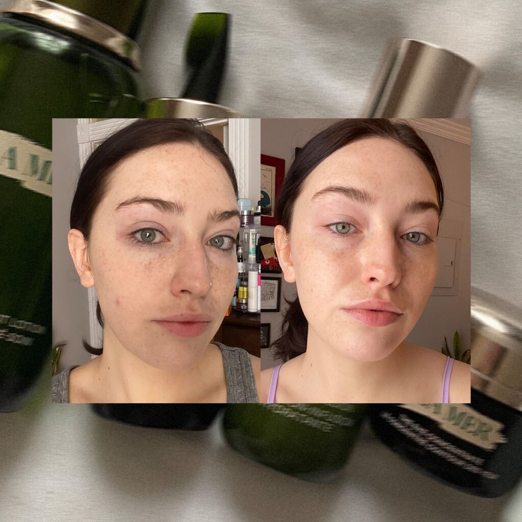 Best Luxury Eye Treatments 2025