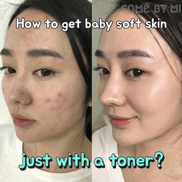 Best PHA Exfoliants for Very Sensitive and Mature Skin 2025