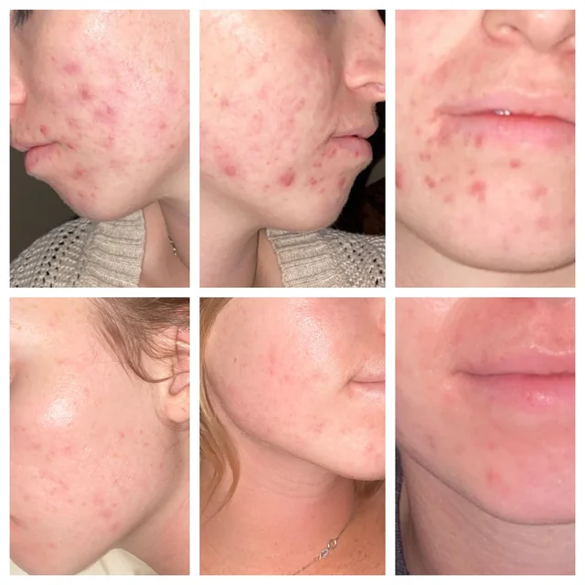 Best Anti-Yellowing Skincare for Smokers 2025