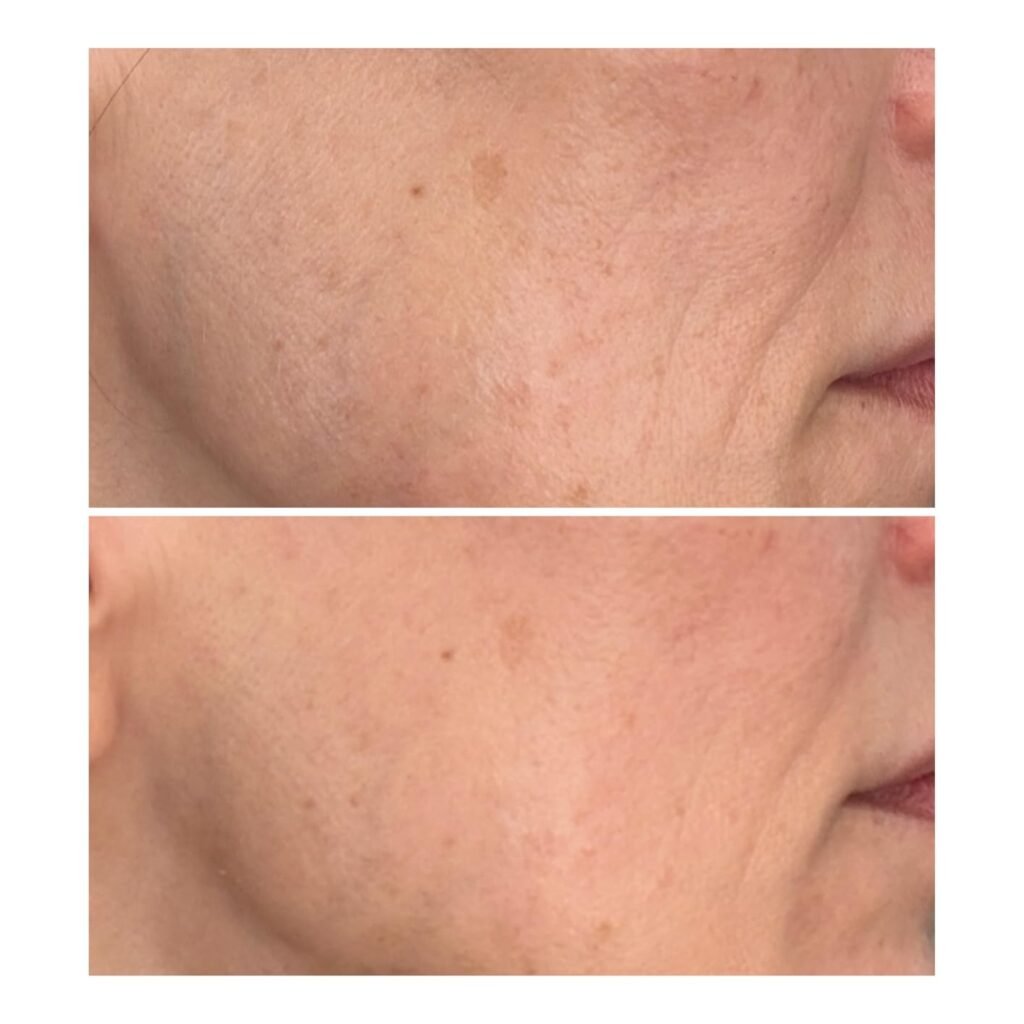 best korean vitamin c serum