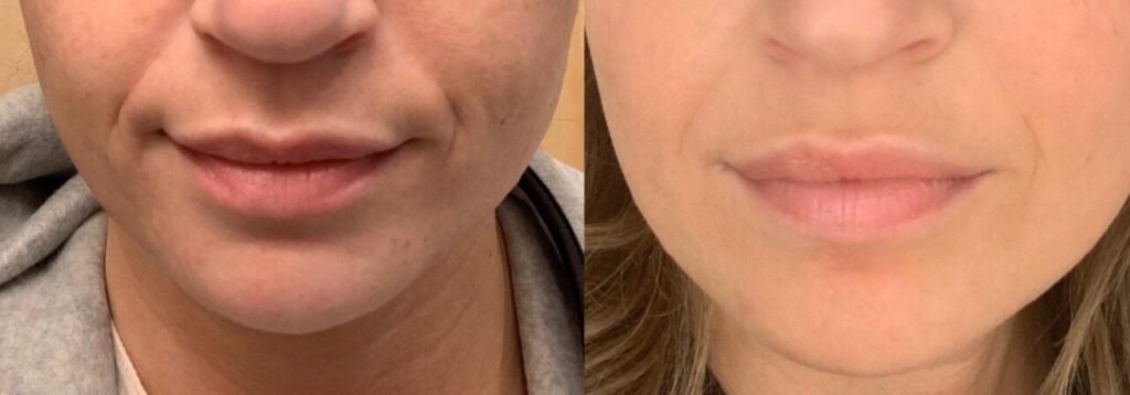 lightweight hydrating serum