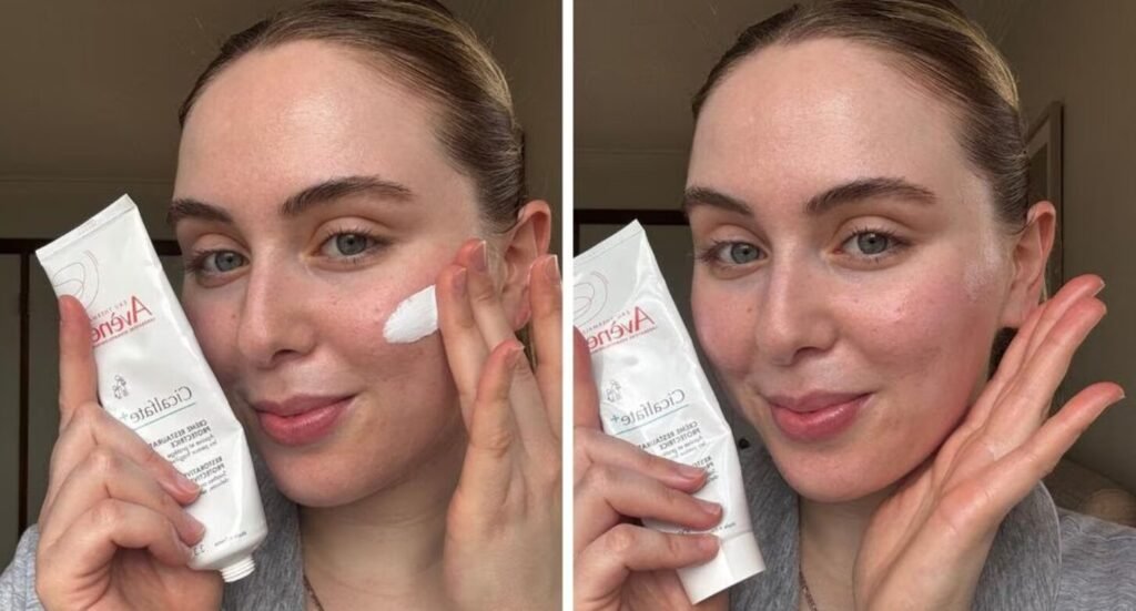 best moisturizer after chemical peel