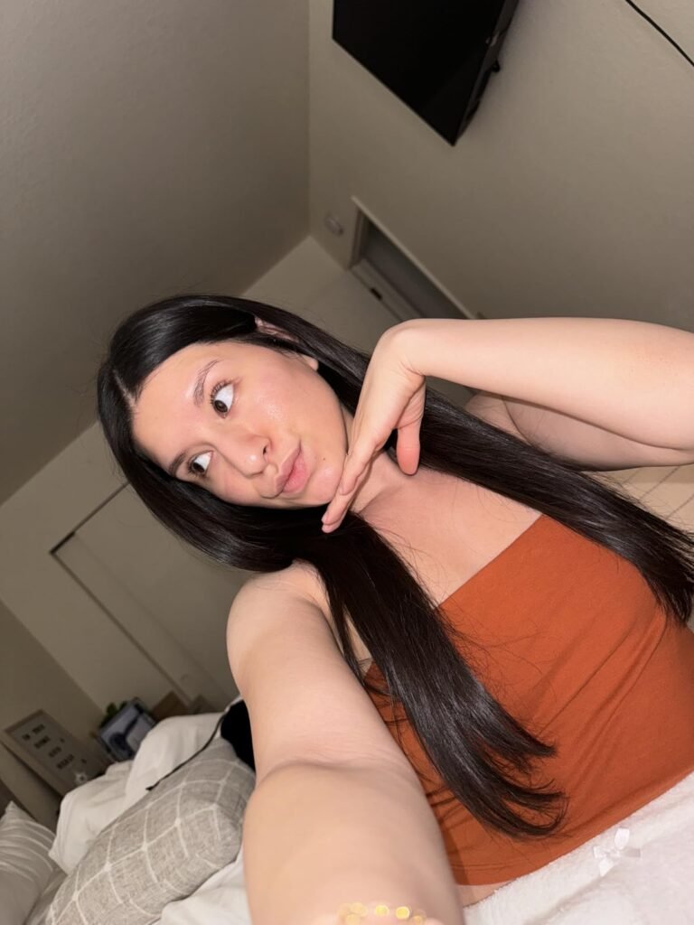 accutane before after