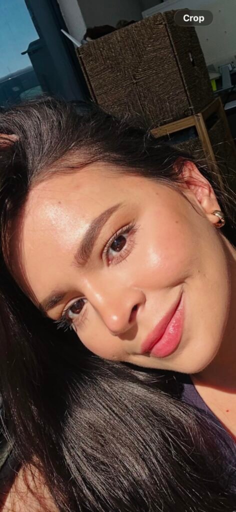 accutane before after