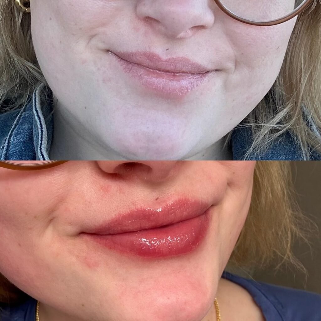 best chapstick for chapped lips